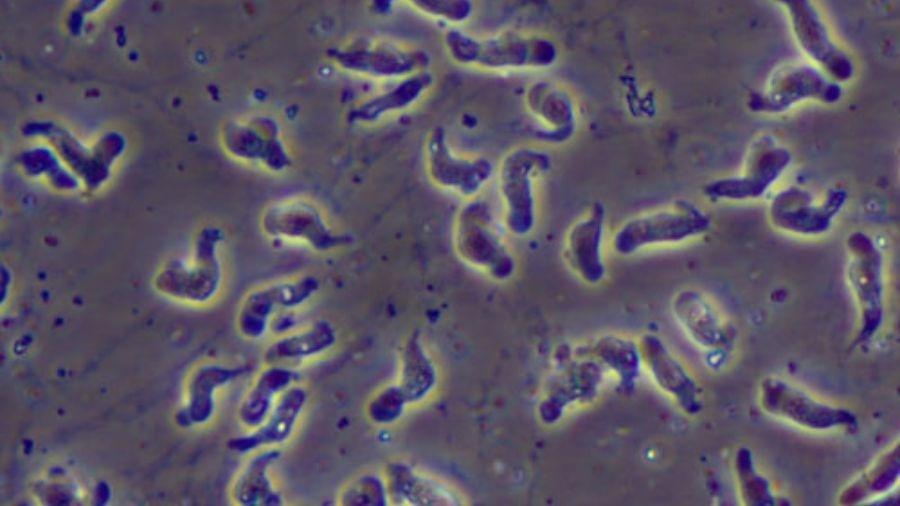 Infecção causada por protozoário que pertence à espécie Naegleria fowleri é considerada rara - Centers for Disease Control and Prevention