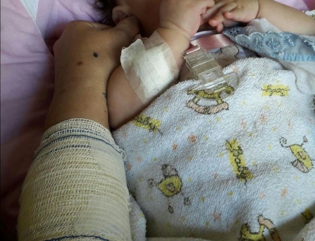 Bebê de três meses foi esfaqueado no braço em assalto; mãe também foi ferida - Arquivo Pessoal