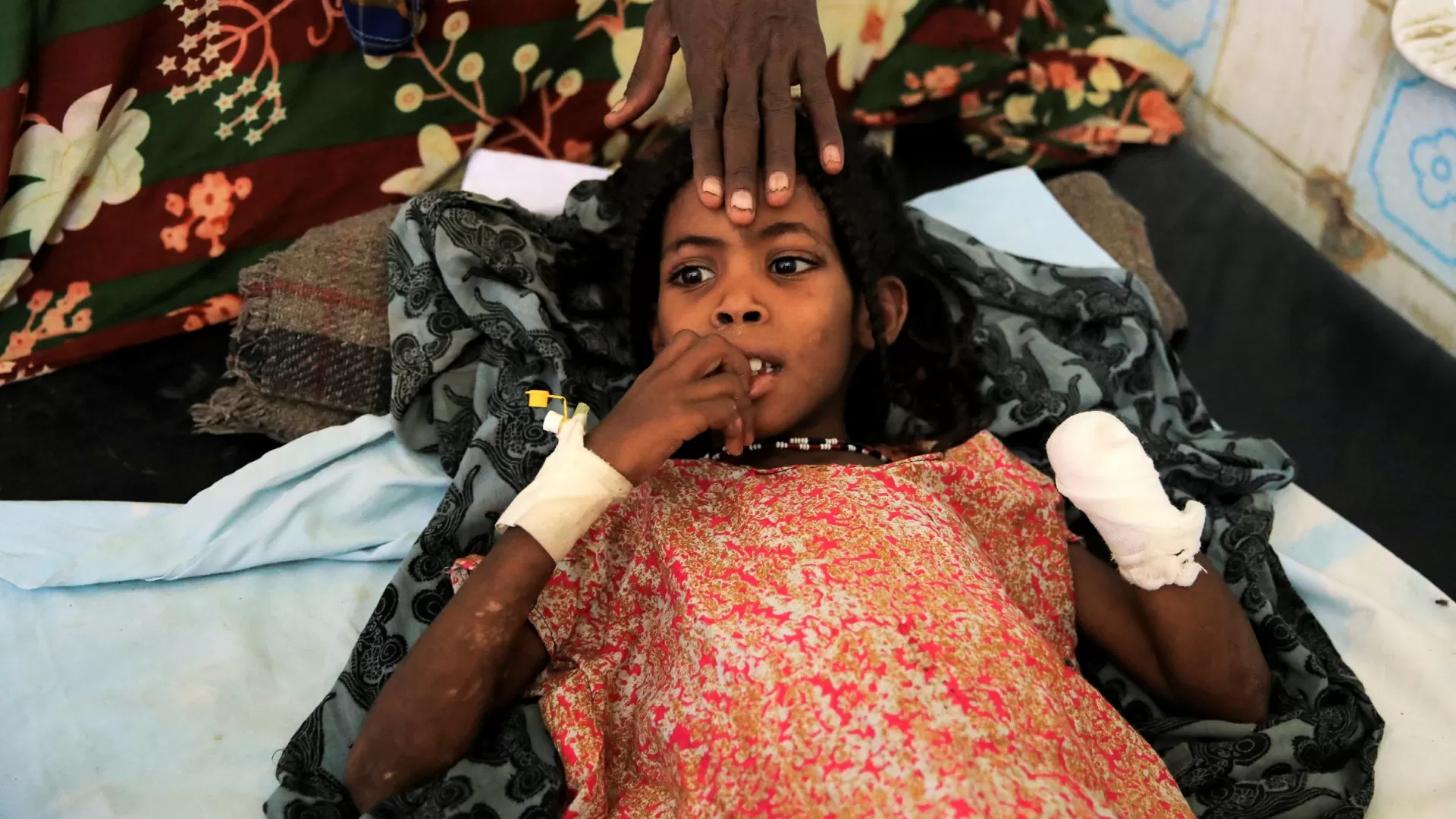 Ayisha Abdu, 8, recebe tratamento após perder a mão esquerda em uma explosão causa por um explosivo deixado perto de sua casa