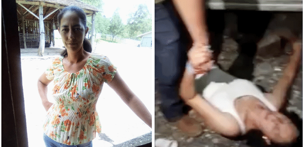 Mulher tem parte da perna amputada após ser atropelada pelo ex em SC