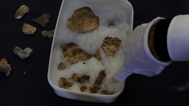 Rebun Kayo aponta para dentes de criança que ele encontrou na Ilha Ninoshima Rebun Kayo aponta para dentes de criança que ele encontrou na Ilha Ninoshima
