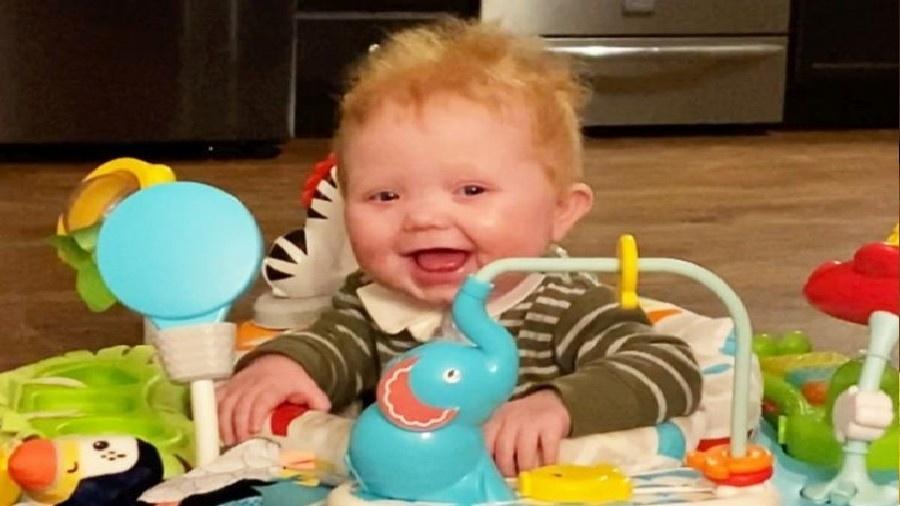 Easton Sinnamon, bebê americano que recebeu transplante duplo de coração e timo. - Divulgação/Duke University