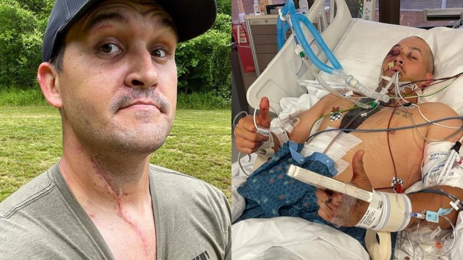 Scott DeShields Jr. quase morreu após um rifle explodir enquanto ele gravava um vídeo para seu canal no YouTube - Reprodução/Instagram/@kentuckyballistics 