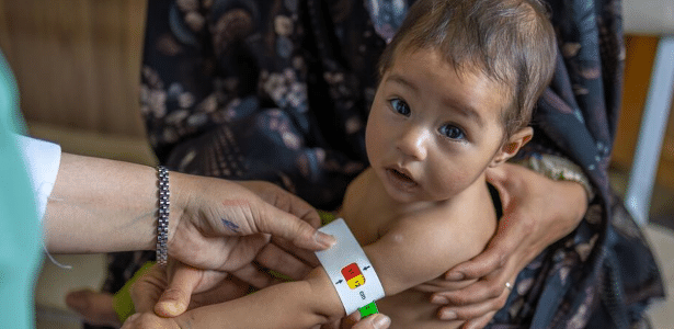 Desnutrição infantil bate recorde no Afeganistão, alerta agência da ONU