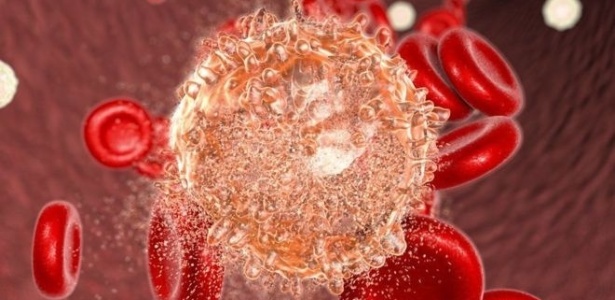 A leucemia linfoblástica (ou linfoide) aguda afeta cerca de 300 mil crianças por ano no mundo todo - Science Photo Library