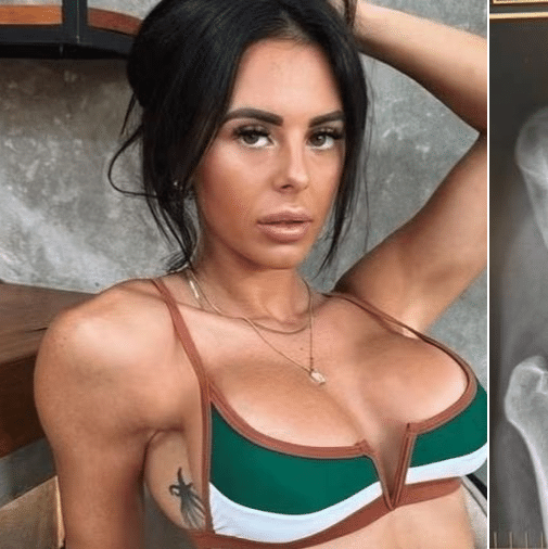 O plug anal pode 'sumir' dentro do corpo? Conhea os riscos O plug anal pode 'sumir' dentro do corpo? Conhea os riscos