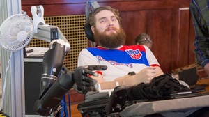 UPMC/Pitt Health Sciences/AFP Photo