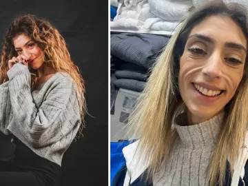 Com anorexia e bulimia, ela pesa 29 kg: 'Gastava para comer e vomitava'