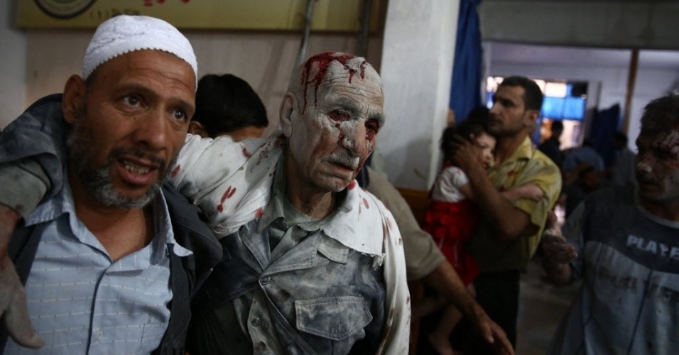 30.jun.2015 - Vítima de ataque aéreo das forças do ditador Bashar Assad é levado a um hospital improvisado em Douma, área controlada pelos rebeldes a leste da capital da Síria, Damasco