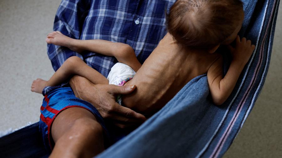 Ministério da Saúde aponta falhas no atendimento de yanomamis - REUTERS/Amanda Perobelli