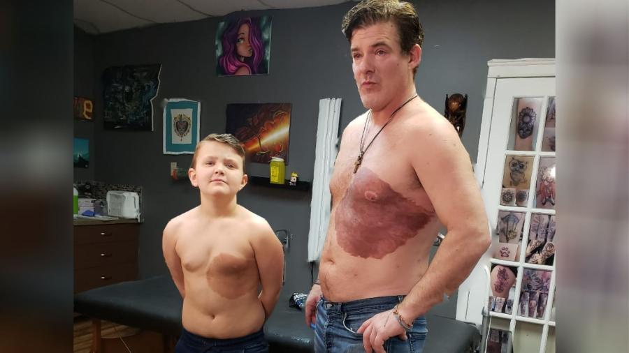 Derek Prue e o filho dele posam com a mesma "marca de nascença", que o pai tatuou para alegrar o filho - Reprodução/Facebook/Juicy Quill Tattoo 