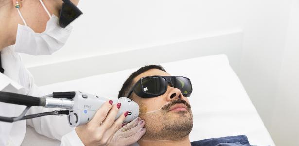 15% da população, e cada vez mais homens, fazem depilação a laser