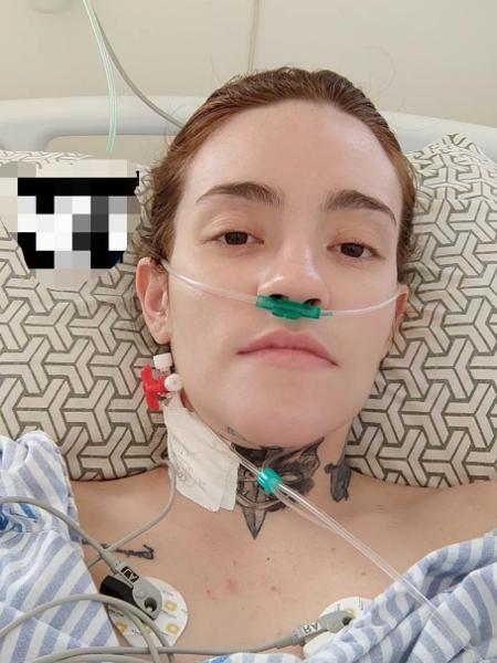 Carolina Arruda, 27, sofre de neuralgia do trigêmeo e sente a pior dor do mundo desde os 16 anos