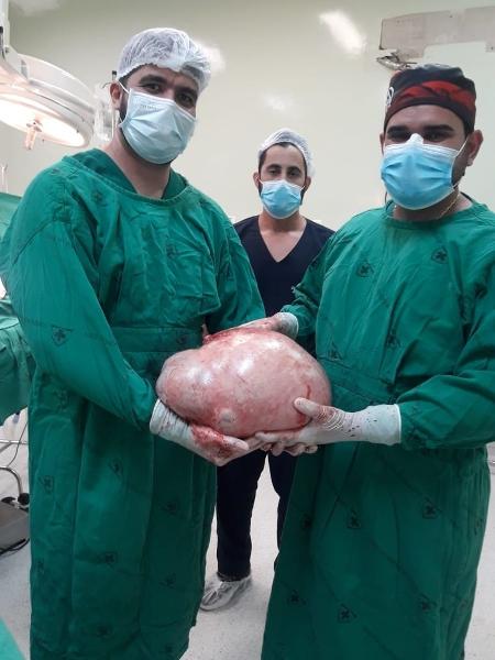 Médicos mostram tumor de 20 kg retirado do ovário de jovem de 25 anos no Acre - Hospital Regional de Juruá / Divulgação