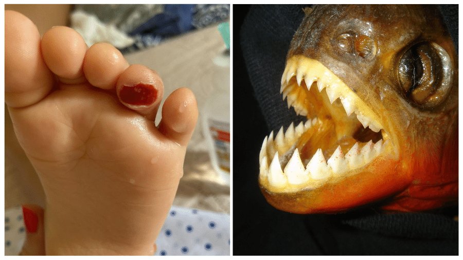 À esquerda, o machucado no pé de Eloísa, de apenas 2 anos e, à direita, uma Pygocentrus nattereri (piranha-vermelha) adulta