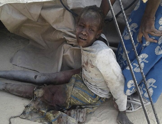 Criança ferida após bombardeio em campo de refugiados em Rann, na Nigéria - MSF/AFP