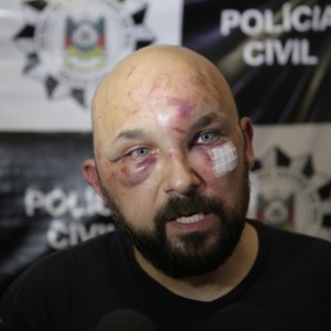Bráulio Pelegrini Escobar, 40, foi agredido por dois taxistas na tarde de quinta-feira (26), em Porto Alegre (RS) - André Ávila/Agência RBS/Estadão Conteúdo