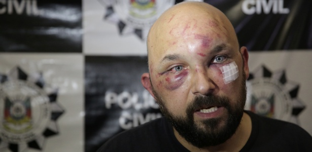 Bráulio Escobar foi agredido por taxistas na tarde de quinta-feira (26), em Porto Alegre - André Ávila/Agência RBS/Estadão Conteúdo
