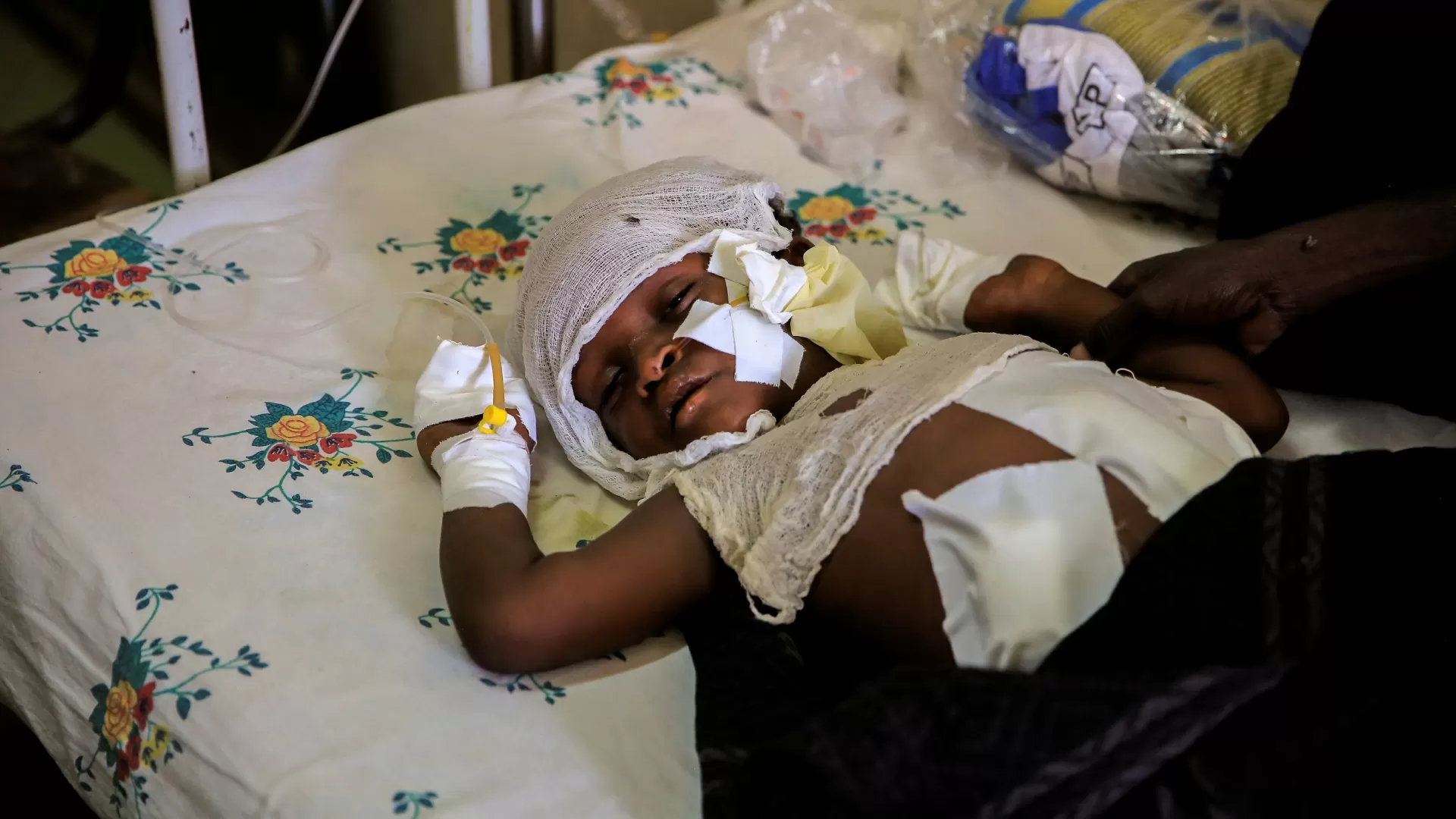 Dawud Ali, 8, dorme ao lado de seu tio, Mohammed Ali, 40, após perder os dedos da mão por causa de explosivos
