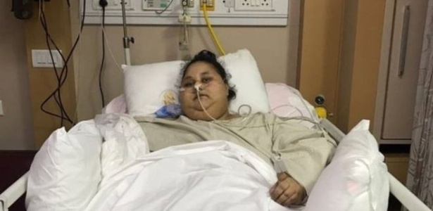 Ex-mulher mais gorda do mundo morreu após perder mais de 300 kg - Saifee Hospital