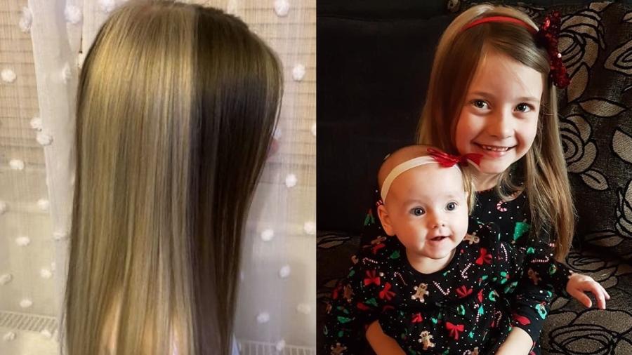 Condição de nascença fez menina ter cabelo bicolor no Reino Unido - Jenny Hill/Facebook/Reprodução
