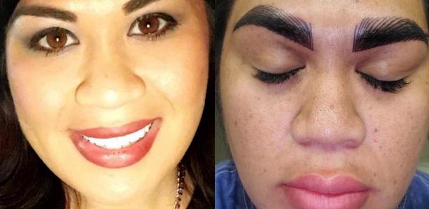 Mulher fica com sobrancelha 'horripilante' após procedimento de R$ 1,7 mil