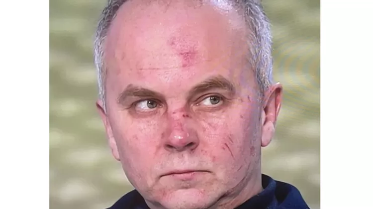 O político ucraniano pró-Rússia Nestor Shufrych após brigar na TV - Reprodução - Reprodução