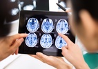 IA do Google alucina e inventa parte do cérebro: 'Extremamente perigoso' (Foto: Getty Images)