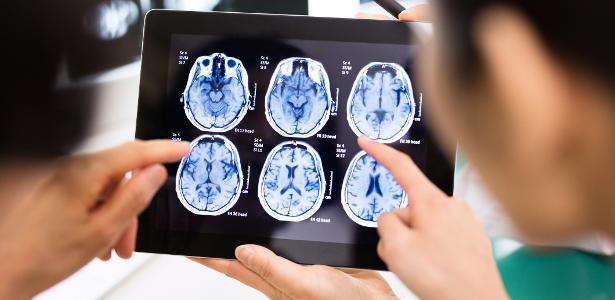 IA do Google alucina e inventa parte do cérebro: 'Extremamente perigoso'