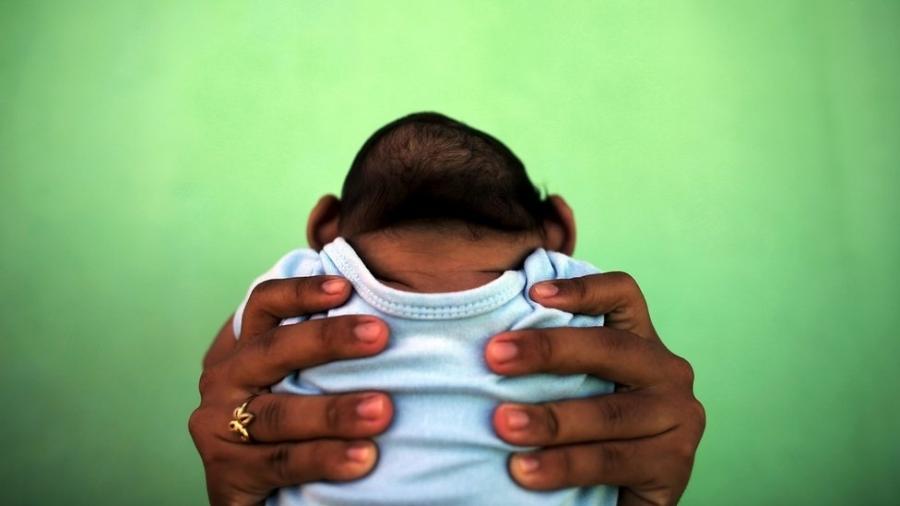 Bebê com microcefalia é erguido por sua mãe em Olinda, em foto de 2016 - REUTERS/NACHO DOCE
