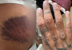 Pauladas e 4 dias na UTI: militar narra 8 h de tortura em curso da PM - Arquivo Pessoal