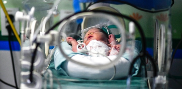 Imagem ilustrativa mostra bebê em incubadora. Enfermeira responderá por crime doloso - Kelly Lima/Eder Content/UOL