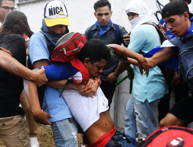 Manifestantes ajudam pessoa ferida em protesto contra o governo de Daniel Ortega - Marvin Recinos/AFP Photo