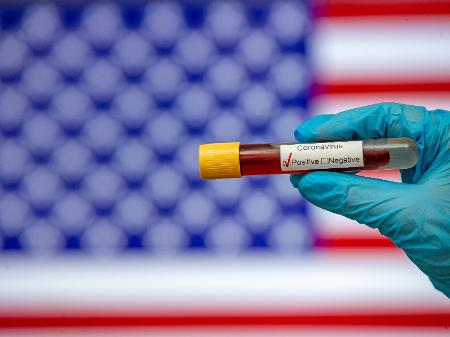 Estima-se que os Estados Unidos gastaram mais de US $ 30 bilhões em hospitalizações por coronavírus desde o início da pandemia - Mehmet Emin Menguarslan / Anadolu Agency