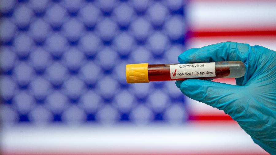 Teste positivo de coronavírus em frente à bandeira dos Estados Unidos (EUA) - Mehmet Emin Menguarslan / Anadolu Agency