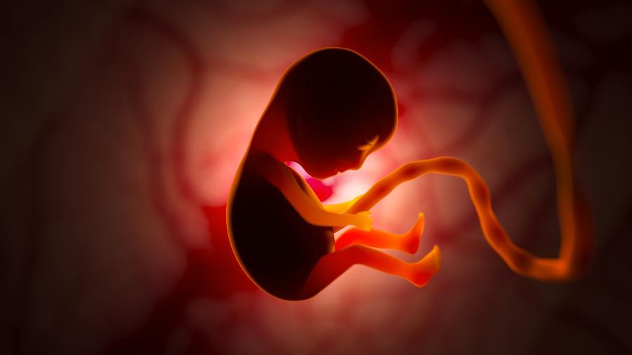 Nó verdadeiro pode se formar quando bebê tem mais espaço para se movimentar