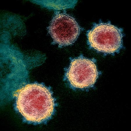 Imagem de microscópio mostra o coronavírus em paciente infectado - National Institutes of Health / AFP