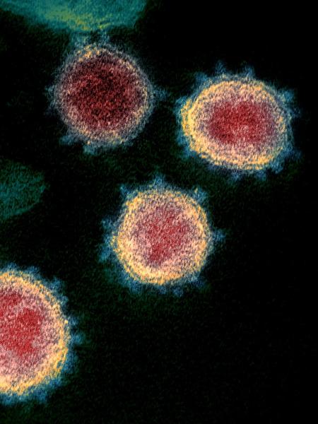 Imagem de microscópio mostra o coronavírus em paciente infectado - National Institutes of Health / AFP