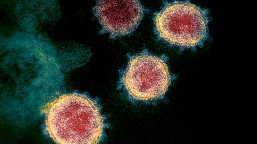 Pesquisadores rastreiam mutações genéticas no coronavírus em todo o mundo - National Institutes of Health / AFP
