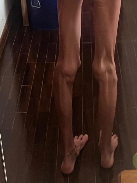 Sofia Ramos, atriz portuguesa que sofre com consequências de anorexia e bulimia