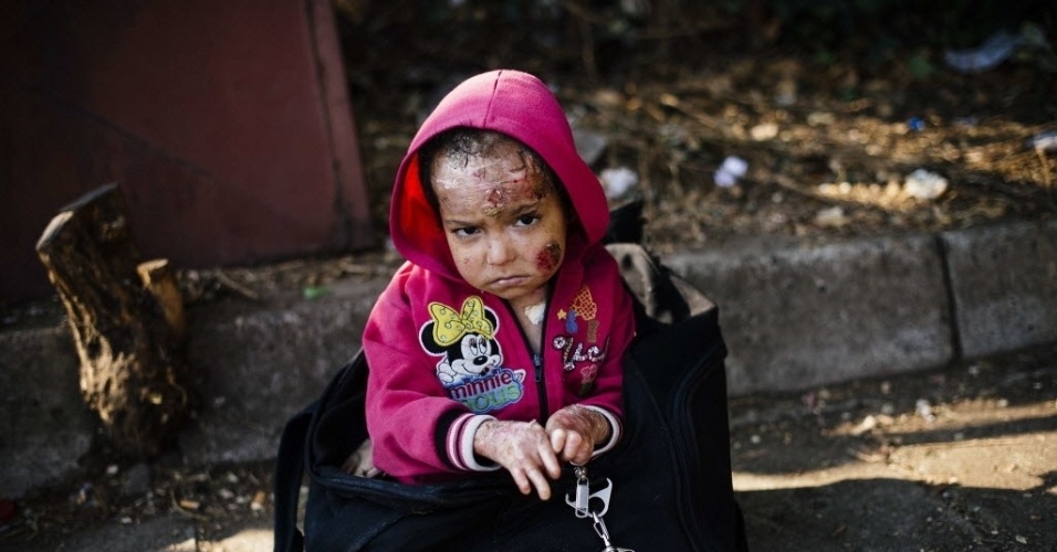 4.ago.2015 - Criança síria ferida em um ataque químico espera o trem em Gevgelija, na fronteira entre Grécia e Macedônia. Muitos imigrantes tentam cruzar a Macedônia para entrar na Europa através da Hungria