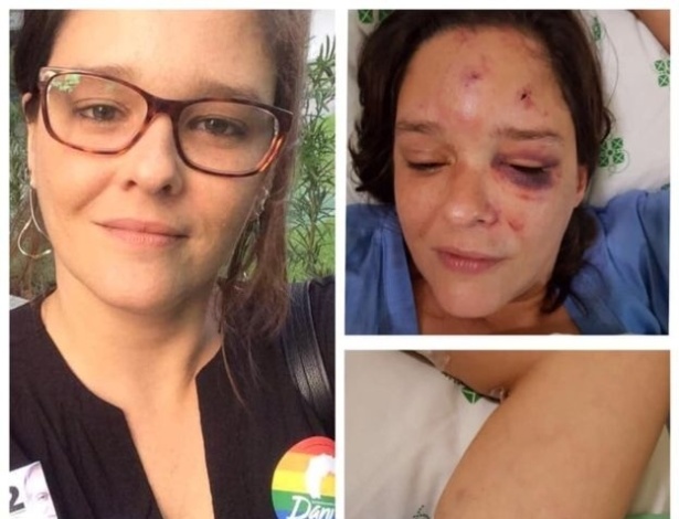 Moradora do Recife diz ter sido agredida e ameaçada por pessoa armada em bar por usar adesivo a favor de Ciro Gomes e contra Jair Bolsonaro