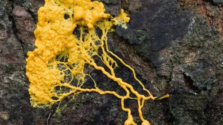 foot - Science Photo Library - Science Photo Library