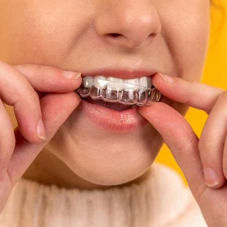 Gastos com aparelho odontológico podem ser deduzidos do IR