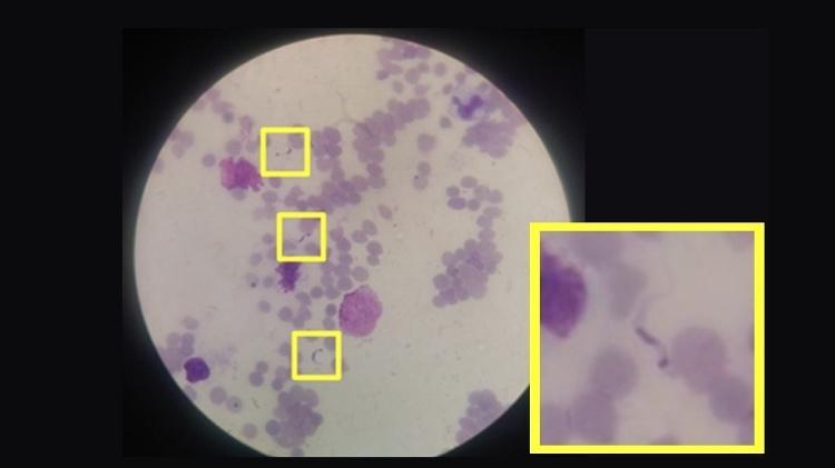 	 Pesquisadores brasileiros desenvolveram um algoritmo capaz de identificar o protozoário Trypanosoma cruzi em fotos de amostras de sangue obtidas com câmeras de dispositivos móveis. Método de baixo custo foi descrito na revista PeerJ e pode ser reproduzido - Acervo dos pesquisadores - Acervo dos pesquisadores