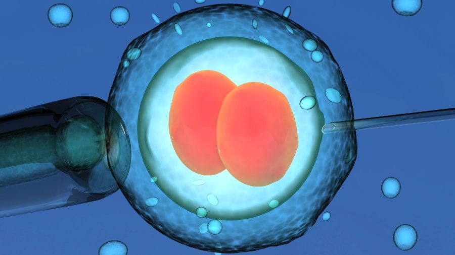 Segundo pesquisa, o ideal é implantar apenas um embrião por vez - iStock