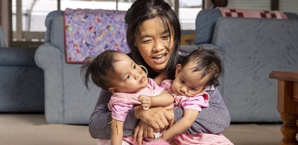 Com ajuda de instituição de caridade, mãe e filhas foram do Butão à Austrália para fazer cirurgia - EPA via BBC