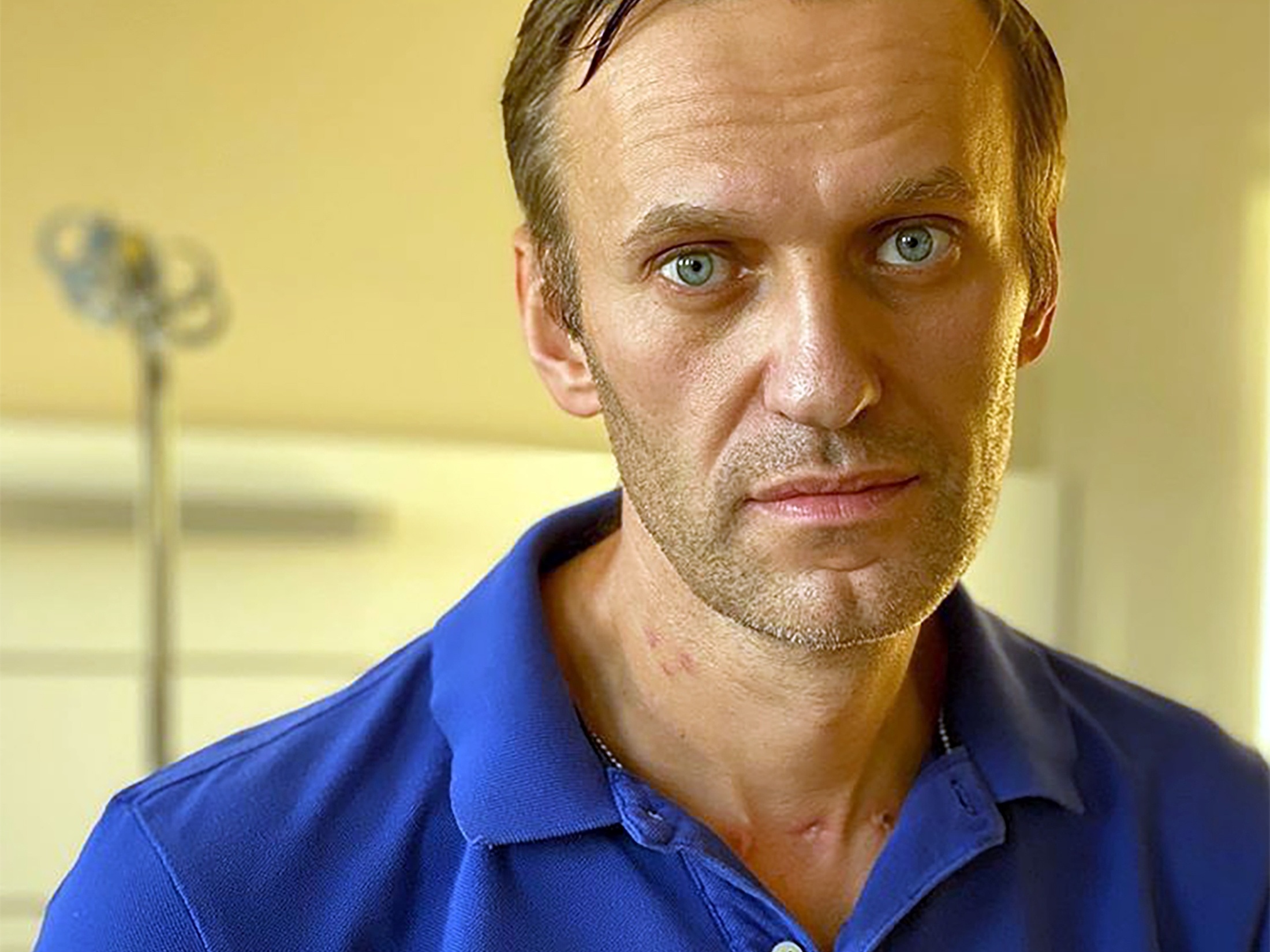 Veneno na cueca: nova técnica russa para matar opositores