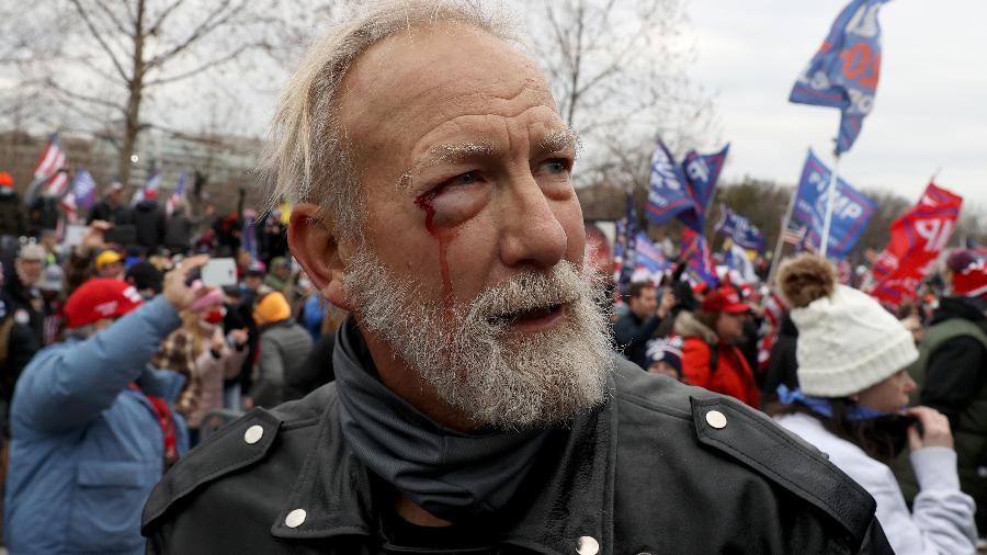 6.jan.2021 - Apoiador do presidente Donald Trump ferido após confronto de manifestantes em frente ao Congresso dos EUA - Tasos Katopodis/Getty Images