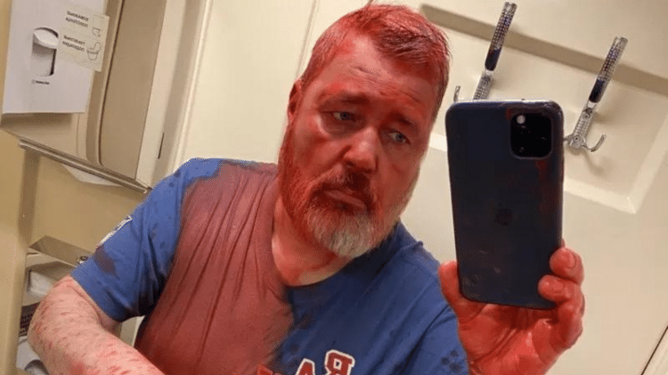 muratov april - DMITRY MURATOV - DMITRY MURATOV